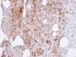 UAP1 Antibody in Immunohistochemistry (Paraffin) (IHC (P))