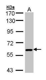 UAP1 Antibody in Western Blot (WB)