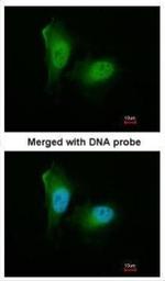 PSMA2 Antibody in Immunocytochemistry (ICC/IF)