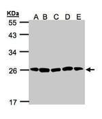 PSMA2 Antibody in Western Blot (WB)