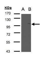 FAN Antibody in Western Blot (WB)