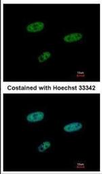 SAMHD1 Antibody in Immunocytochemistry (ICC/IF)