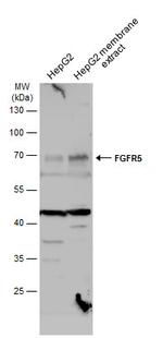 FGFR5 Antibody in Western Blot (WB)