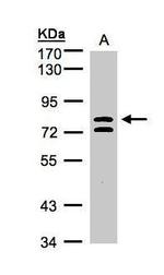 L3MBTL1 Antibody in Western Blot (WB)