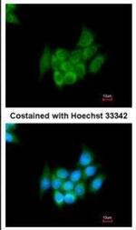 Angiotensinogen Antibody in Immunocytochemistry (ICC/IF)