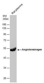 Angiotensinogen Antibody in Western Blot (WB)