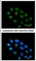 ZNF7 Antibody in Immunocytochemistry (ICC/IF)