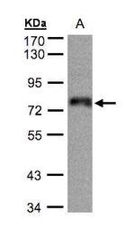 ZNF7 Antibody in Western Blot (WB)