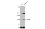TYK2 Antibody in Western Blot (WB)