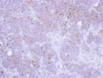 ST3GAL2 Antibody in Immunohistochemistry (Paraffin) (IHC (P))