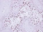 IP6K1 Antibody in Immunohistochemistry (Paraffin) (IHC (P))