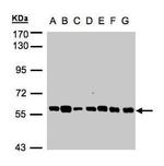 TULP1 Antibody in Western Blot (WB)