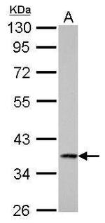 Cathepsin S Antibody in Western Blot (WB)