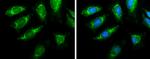 PDHA1 Antibody in Immunocytochemistry (ICC/IF)