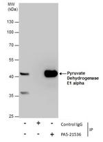 PDHA1 Antibody in Immunoprecipitation (IP)