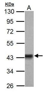 PDHA1 Antibody in Western Blot (WB)