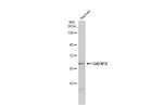 GALNT2 Antibody in Western Blot (WB)