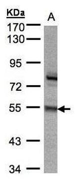 ZNF165 Antibody in Western Blot (WB)