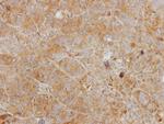 CHI3L2 Antibody in Immunohistochemistry (Paraffin) (IHC (P))