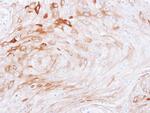 BCAT2 Antibody in Immunohistochemistry (Paraffin) (IHC (P))