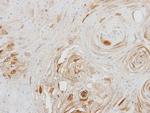 BCAT2 Antibody in Immunohistochemistry (Paraffin) (IHC (P))