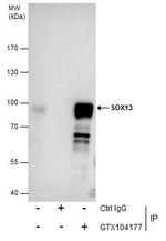 SOX13 Antibody in Immunoprecipitation (IP)