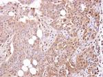 STOML1 Antibody in Immunohistochemistry (Paraffin) (IHC (P))