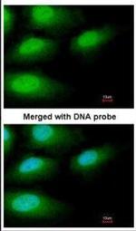 IRAK-M Antibody in Immunocytochemistry (ICC/IF)