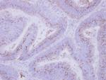 INPP5F Antibody in Immunohistochemistry (Paraffin) (IHC (P))