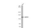 INPP5F Antibody in Western Blot (WB)