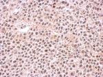 PSMC6 Antibody in Immunohistochemistry (Paraffin) (IHC (P))