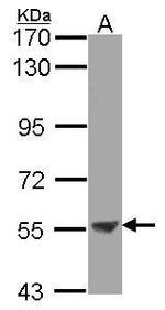 ENTPD3 Antibody in Western Blot (WB)