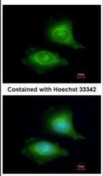 LZTFL1 Antibody in Immunocytochemistry (ICC/IF)