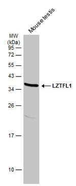 LZTFL1 Antibody in Western Blot (WB)