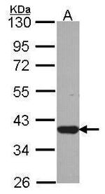 LZTFL1 Antibody in Western Blot (WB)