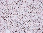 LDB1 Antibody in Immunohistochemistry (Paraffin) (IHC (P))