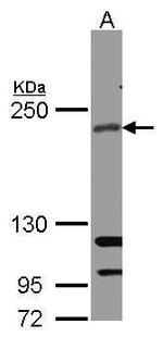 RICTOR Antibody in Western Blot (WB)