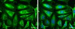 TPI1 Antibody in Immunocytochemistry (ICC/IF)