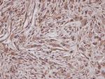 GRAP Antibody in Immunohistochemistry (Paraffin) (IHC (P))