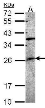 GRAP Antibody in Western Blot (WB)