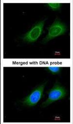 15-PGDH Antibody in Immunocytochemistry (ICC/IF)