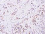 15-PGDH Antibody in Immunohistochemistry (Paraffin) (IHC (P))