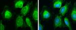 SDHB Antibody in Immunocytochemistry (ICC/IF)