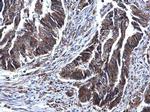 SDHB Antibody in Immunohistochemistry (Paraffin) (IHC (P))