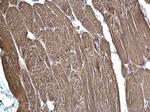 SDHB Antibody in Immunohistochemistry (Paraffin) (IHC (P))