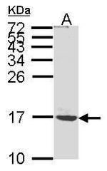 ATP5G1 Antibody in Western Blot (WB)