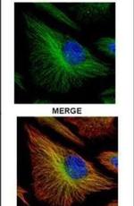 TRADD Antibody in Immunocytochemistry (ICC/IF)