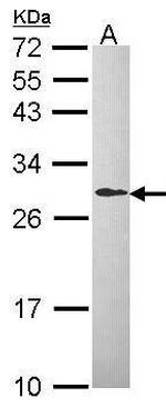 DCXR Antibody in Western Blot (WB)