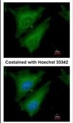 SOCS4 Antibody in Immunocytochemistry (ICC/IF)