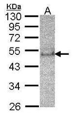 SOCS4 Antibody in Western Blot (WB)